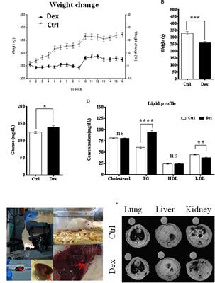 Metabolomics Based Profiling of Dexamethasone Side Effects in Rats